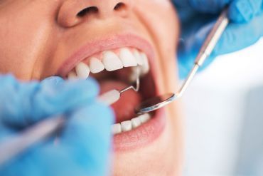 Endodoncia