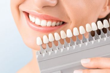 Estética dental