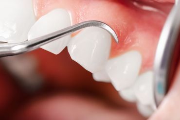 Periodoncia
