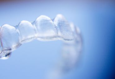 ¿Cuándo es recomendable la ortodoncia invisible?