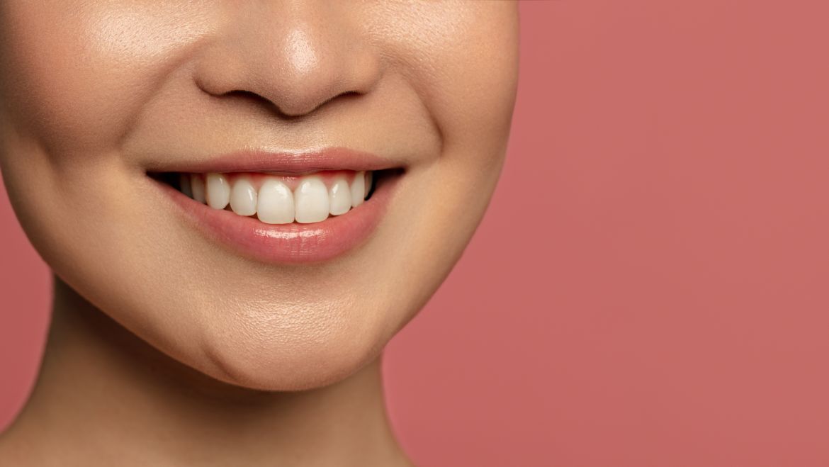 El uso de las carillas dentales en estética dental