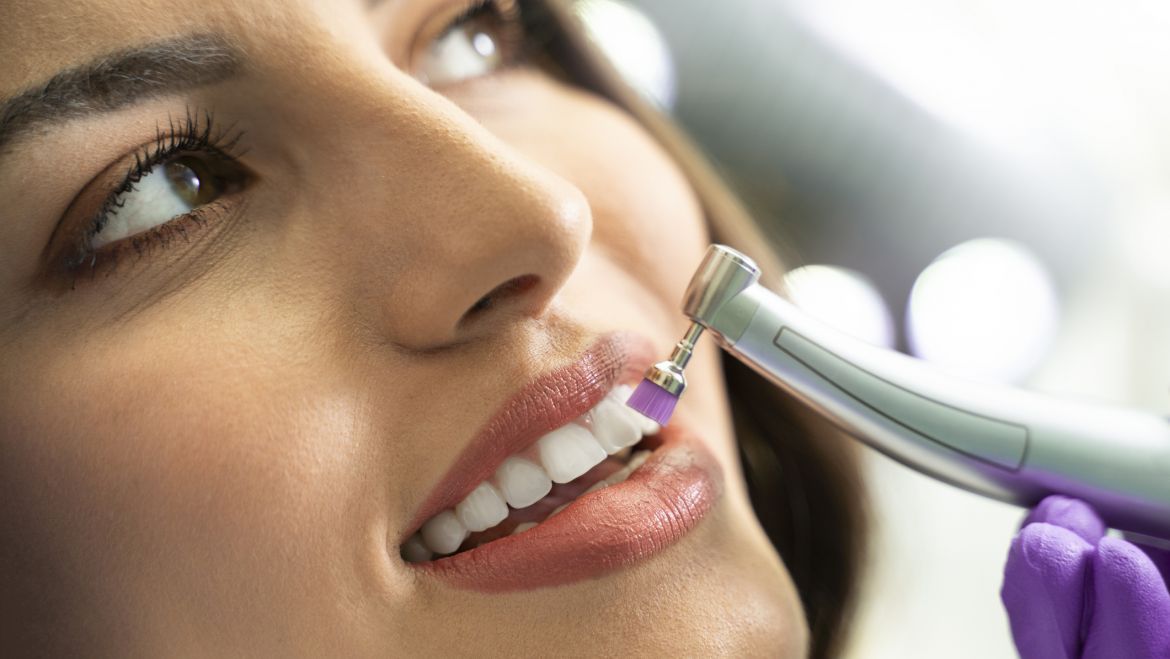 ¿Cuáles son los diferentes tipos de limpieza dental?