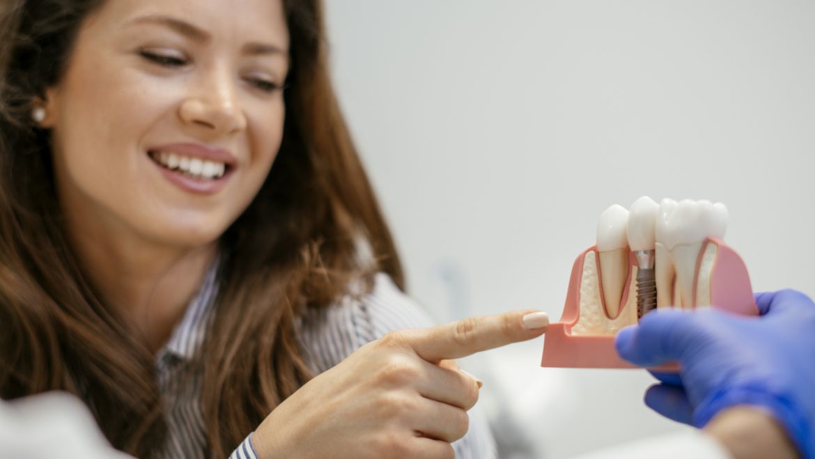 Implantes dentales: la solución definitiva para la pérdida de dientes