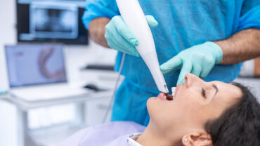 ¿Qué ventajas ofrece el escáner dental 3D?