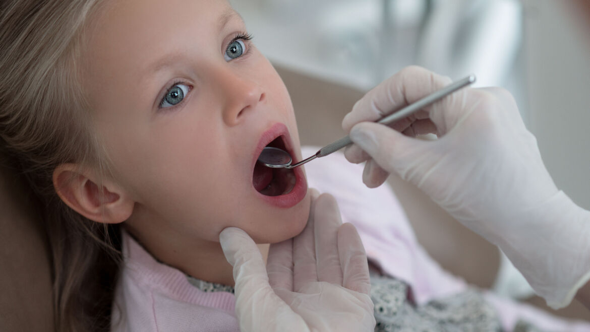 Control de placa bacteriana en niños: la base de una sonrisa saludable