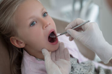 Control de placa bacteriana en niños: la base de una sonrisa saludable
