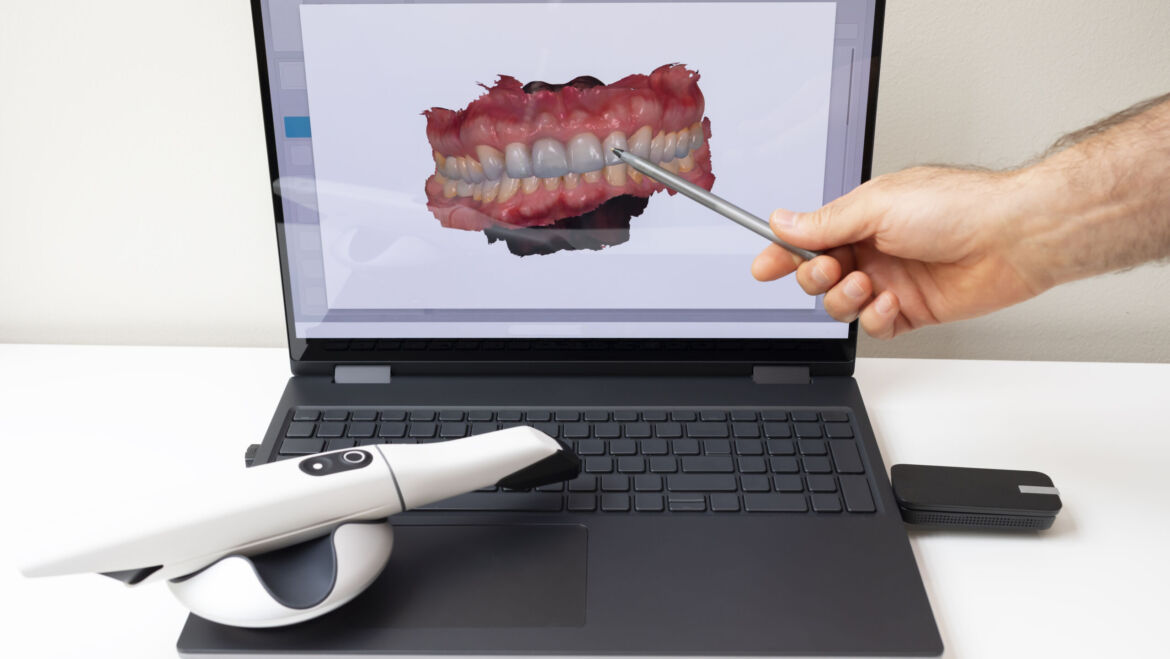Uso de escáner intraoral para planificar tratamientos de implantes