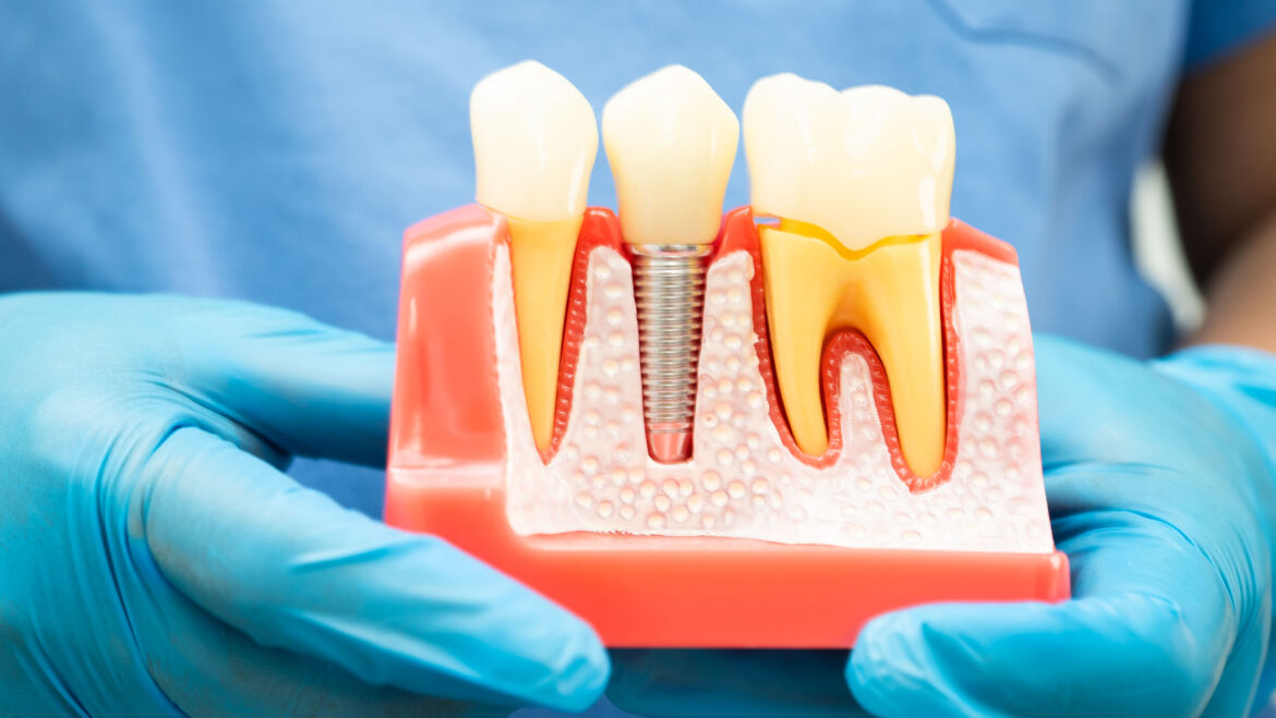 Implantes y cirugía maxilofacial: coordinación multidisciplinar